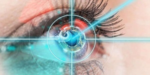    Лазерная коррекция зрения в офтальмологическом центре «ОфтальмоС» 